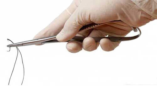 نخ مخصوص لیفت واژن